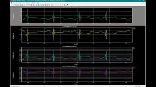 A 9T SRAM Computation-in-Memory Architecture with High-Precision MAC