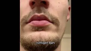 Inoiv Men - Bartwuchs Set Testimonial