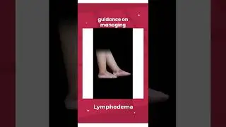Can Lymphedema Cause Leg and Ankle Swelling in Seniors?