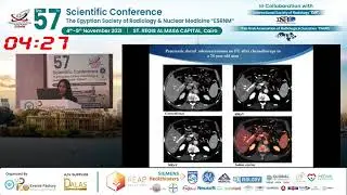 The added Value of Spectral Detector CT in assessment of Focal Pancreatic Lesions