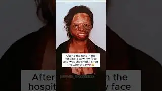 Survivor of an acid attack Lakshmi Agarwal💖🔥 #motivation #goals #shorts #viral