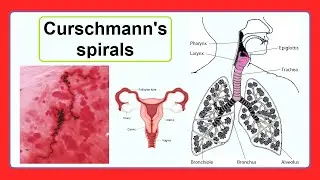 Curschmann's spirals