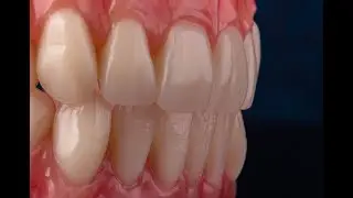 Dental Photography Course Equipment Considerations. ARTD 120