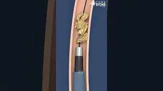 How URSL is done animation?