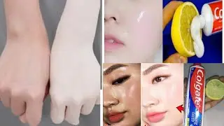 Colgate Toothpaste & Lemon for Skin Whitening|| Remove Acne pimple with Colgate//instant whitening.