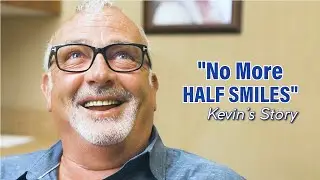 Complete Smile Makeover - How All-on-X Implants Changed This Man's Life!
