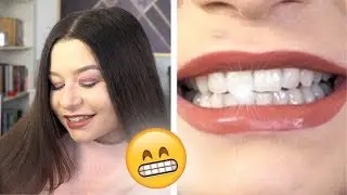 Sekret moich BIAŁYCH ZĘBÓW | YouTuberzy Ci tego NIE POWIEDZĄ!
