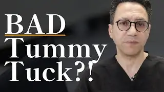Signs of a Bad Tummy Tuck: How to Spot & Fix Botched Results