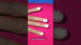 Spot Diagnosis #imwell