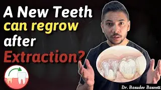 A New Teeth can grow after extraction in adults | Dentist Explains😳