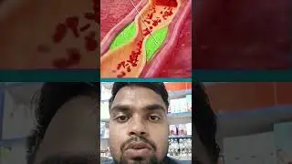 heart ❤️ attack 💔kiu hota hai. #heartbit #doctor #heartattack #prakashpharmacy