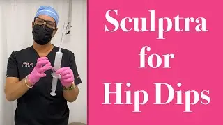 Sculptra for Hip Dips - Skinny BBL San Diego 🍑