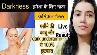 Dark Underarms Removal Home Remedies | Underarms Whitening Tips | Underarms Darkness Removal 