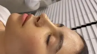 [💉] virtual rhinoplasty procedure ༊*&middot;˚ ꒰ 369Hz subliminal audio! ꒱
