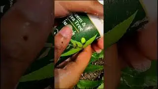 pimple removal Neem face wash