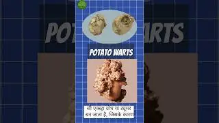POTATO WARTS 🥔🤔😲😱 | #shorts
