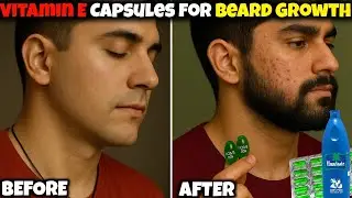 Vitamin E Capsule Se Beard Kaise Ugayein? EVION 400 Real Result |Vitamin E Capsules For Beard Growth