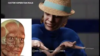 The Skinless Man scares Keller