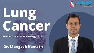 Lung Cancer Treatment in Bangalore | Hemato Oncologist & Medical Oncologist in Bangalore |DR Mangesh