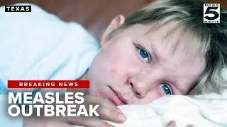 Measles exposure alert issued for Texas after visitor tests positive