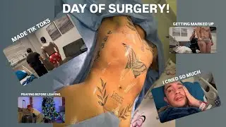 MY MALE BBL SURGERY IN MEXICO || POST OP DAY 1