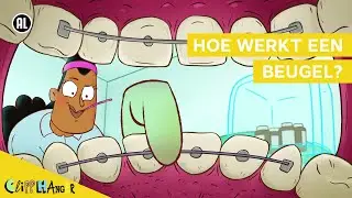 Hoe werkt een beugel?