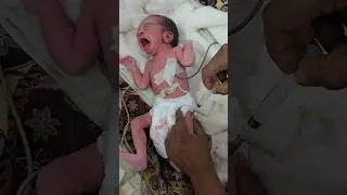 Baby's Vaccine Shot 😱#shorts #newborn #babycare #hospitalcare #nicucare #pretermbaby #vaccine #fyp