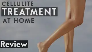 Cellulite Treatment at Home | How To Get Rid of Cellulite Naturally Quickly