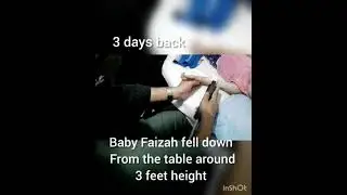 Elbow Injury Baby Faizah in Pain Matrix Rhythm Therapy Dr Shaikh Physicare Physiotherapy Clinic Pune