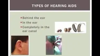 Chapter 13 - Amplification and Sensory Systems