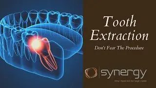 Fear of Tooth Removal? How We Make It Comfortable!