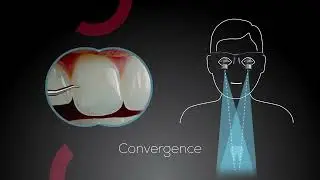 Discover Admetec&reg; Loupes Convergence