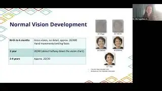 Shaping Futures: Pediatric Eye Care for Health Professionals