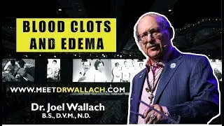 BLOOD CLOTS AND EDEMA - DR. JOEL WALLACH