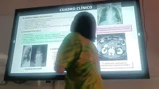 LINFOMA HODKING