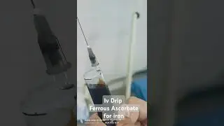 Iv drip #ferrous ascorbate for iron 💉#short video