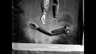 The extraordinary early prostheses made by James Gillingham, 1900