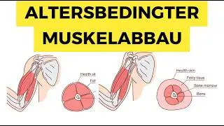 Warum Muskelmasse der Schlüssel zu einem langen Leben ist