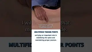 Определение триггерных точек многораздельной мышцы
