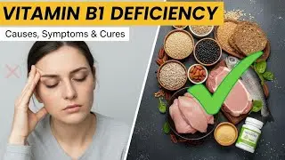 Vitamin B1 Deficiency | Can Damage Your Brain & Heart | Warning Signs You Must Know/ #VitaminB1