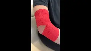Easy Elbow Application to help prevent hyperextension