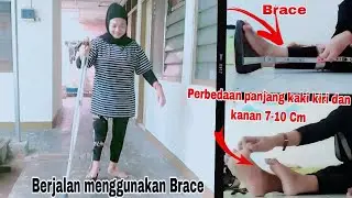 Mencoba Berjalan Menggunakan Brace Lagi||Difabel Polio