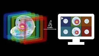 Instant Volume Imaging