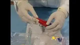 Smartbank.it - Sacca di prelievo sangue cordonale