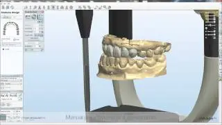 Dental System&trade; 2010 - Dynamic Virtual Articulation