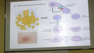 CBL - immediate and delayed hypersensitivity part 3 module B