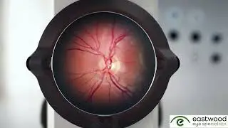 New Workflows for Glaucoma Assessment & Treatment at Eastwood Eye Specialists