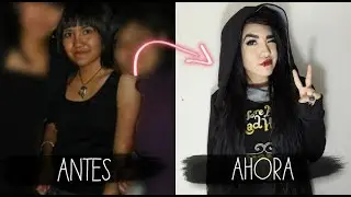 ♡ ACLARA TU PIEL♡ Regresa a tu tono natural ♡ &iquest;Como aclare mi piel? ♡