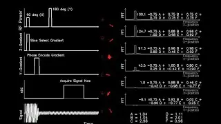 MRI: Physics and Image Creation - Phase Encoding 1D Example (Part 17/18)