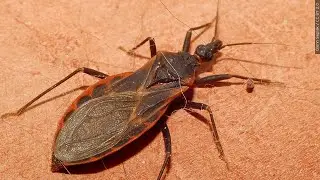 Covering Your Health: Chagas Disease